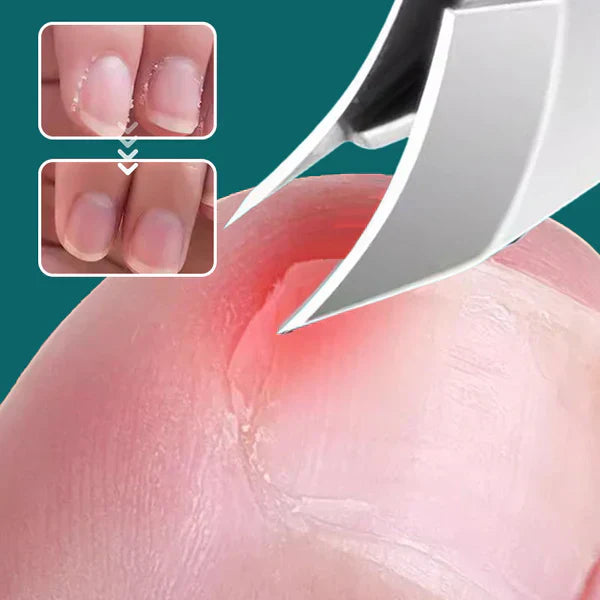 Anti-Splash Angled Nail Clipper 3-Piece Set